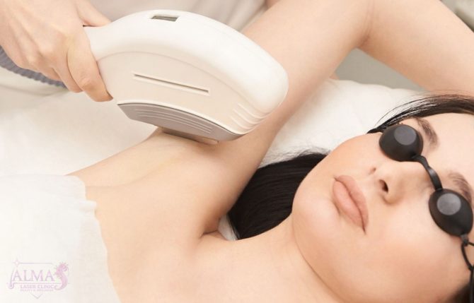 IPL Laser Treatment - Almas Laser Clinic