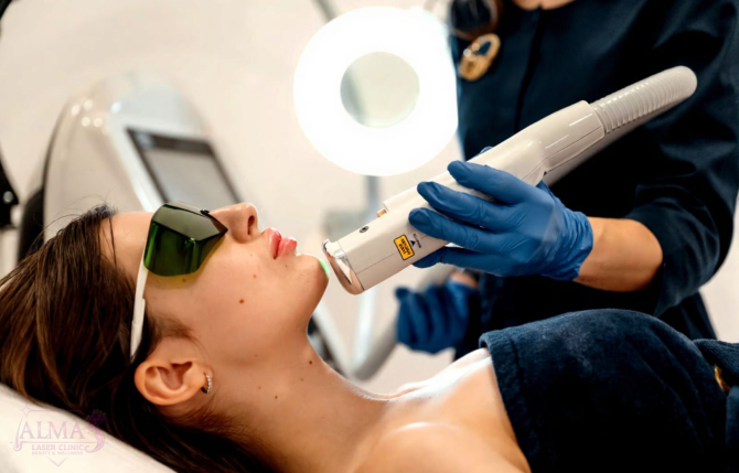reckles-removal-Almas-Laser-Clinic.webp